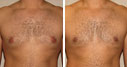 Before & After Photos